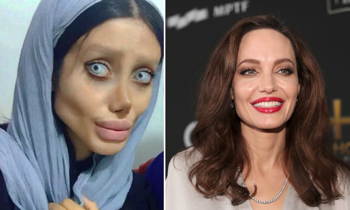 Angelina Jolie Wannabe Mocked as ‘Zombie’ for Botching ’50 Operations ...