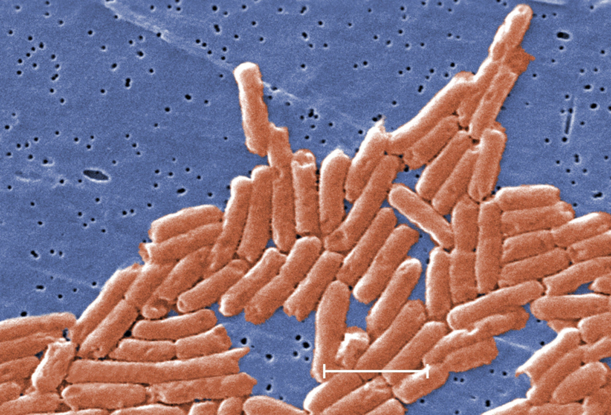 Salmonella Outbreak Linked to Ground Beef